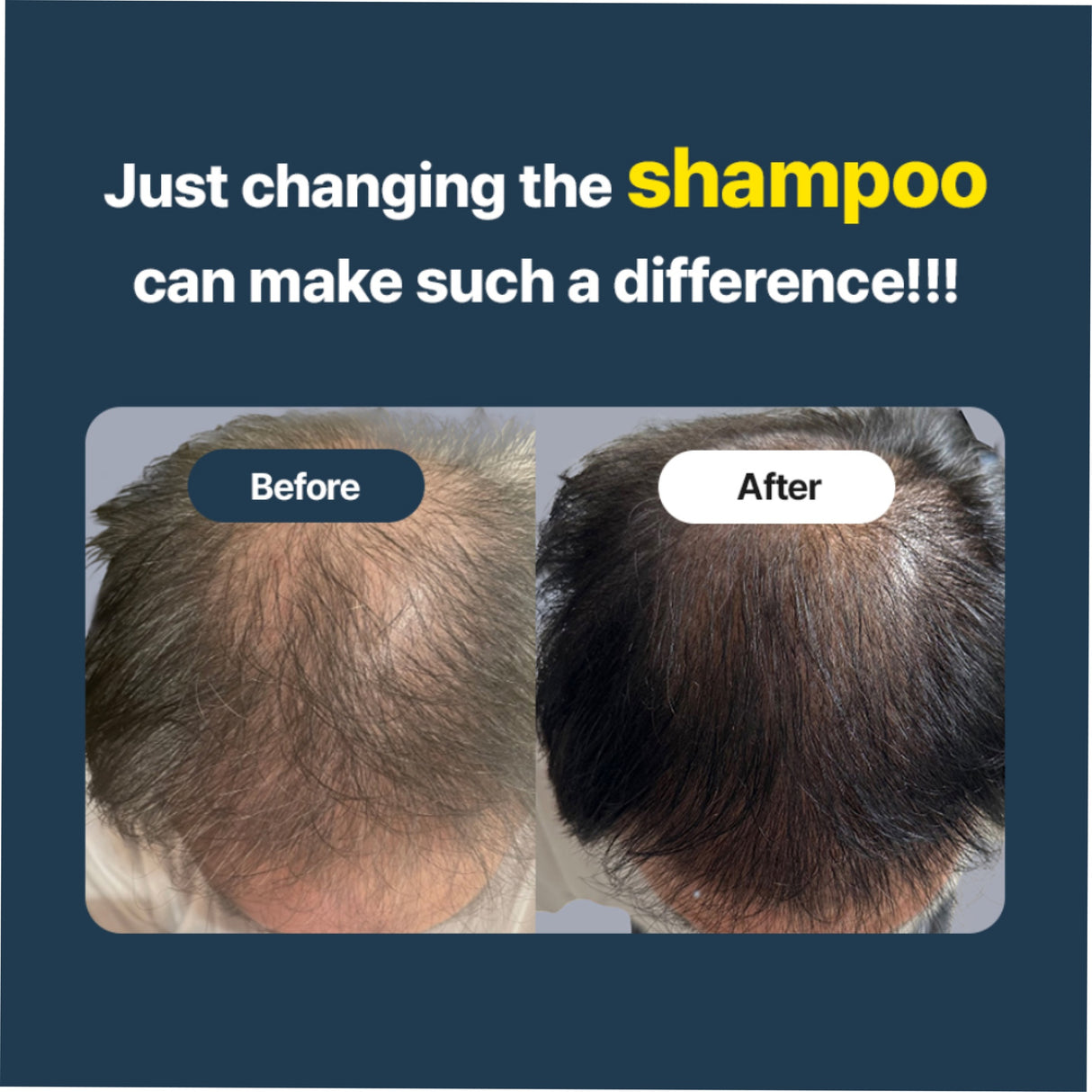 EO Fortifying Anti-Hair Loss Shampoo For All Types 250ml