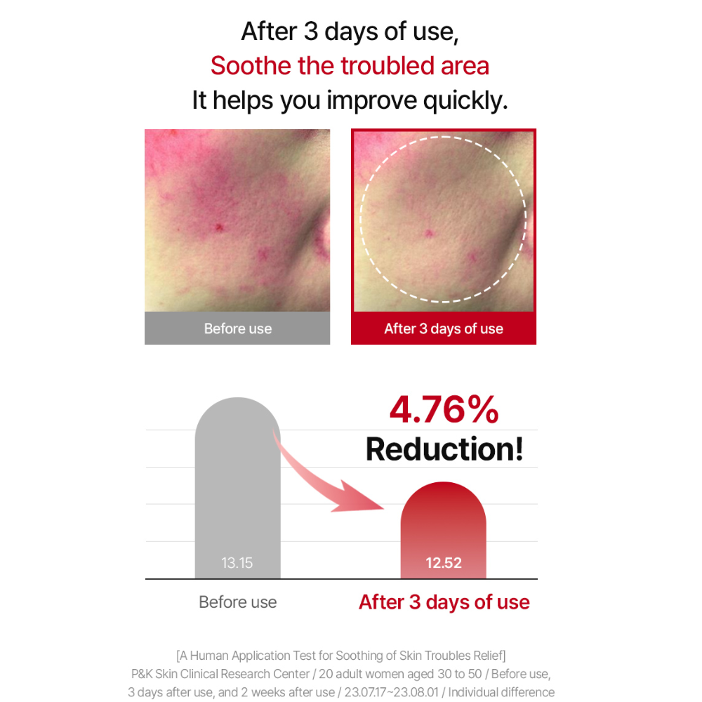 Raviel Acerola Dark Spot & Blemish Care Cream 50ml