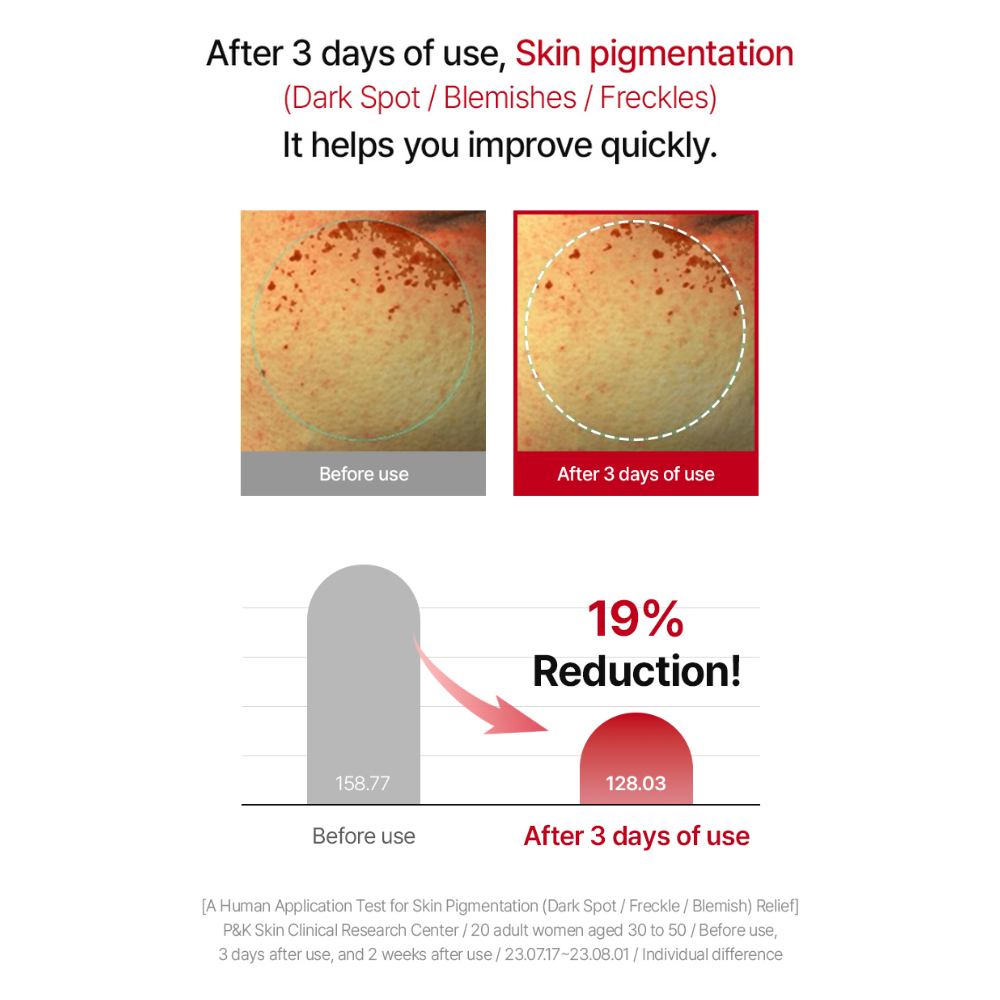 Raviel Acerola Dark Spot & Blemish Care Cream 50ml